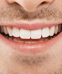 Smile teeth