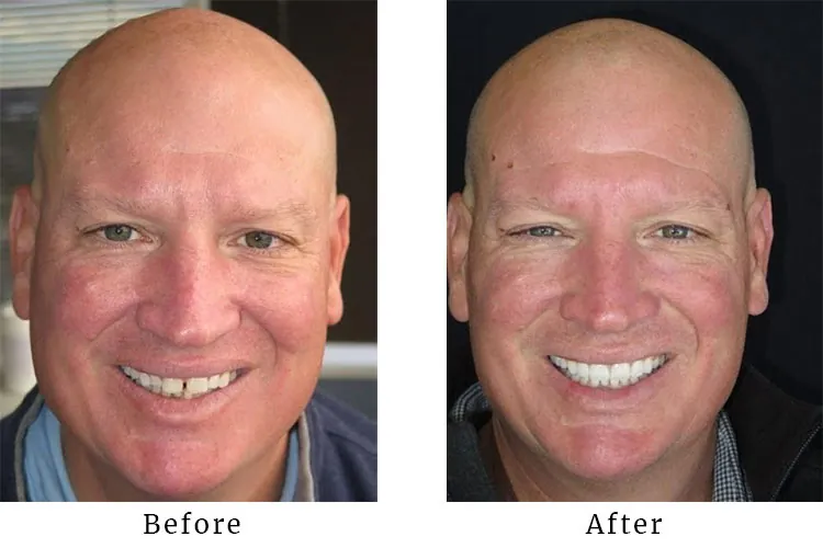 Real patient before after