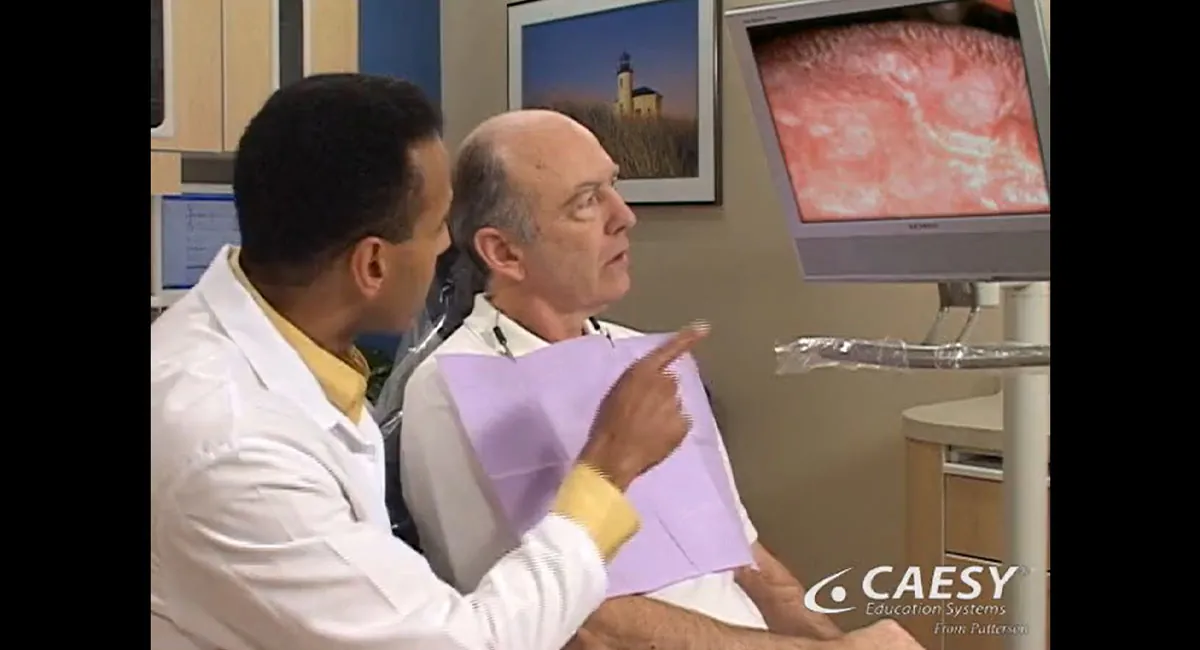 Oral cancer exam thumbnail
