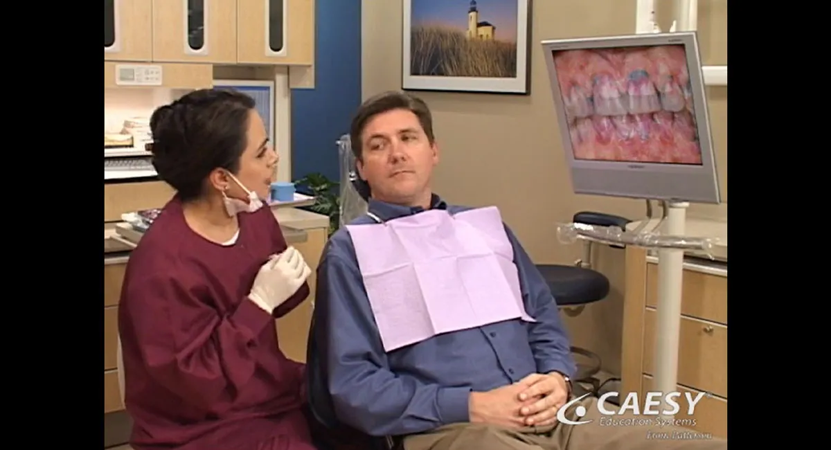Full mouth debridement thumbnail