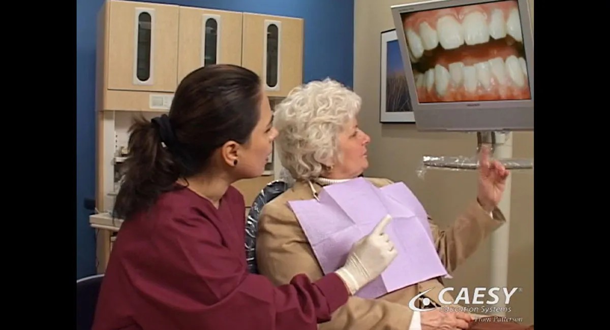 Prophylaxis cleaning video thumbnail