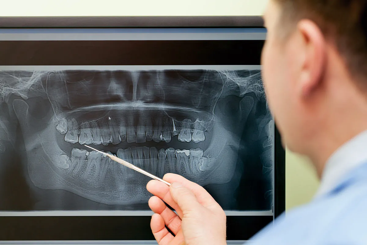 Dental x-rays