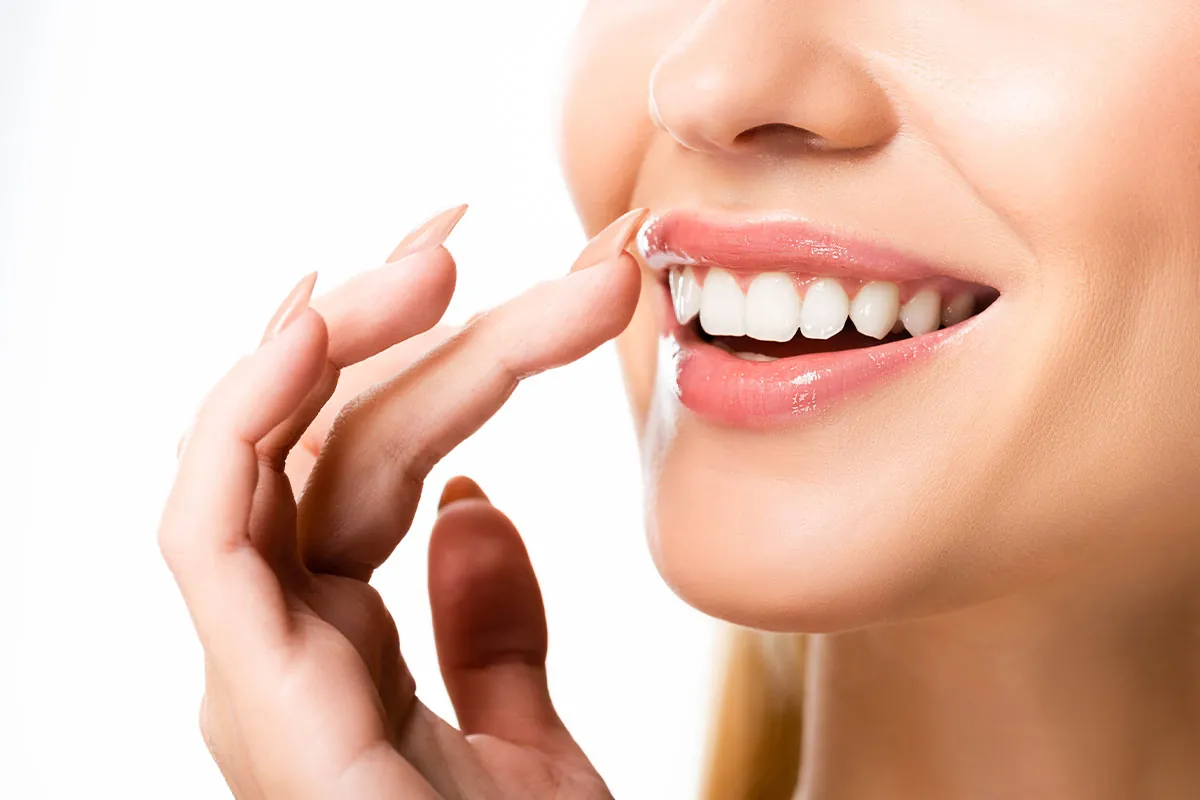 Dental veneer