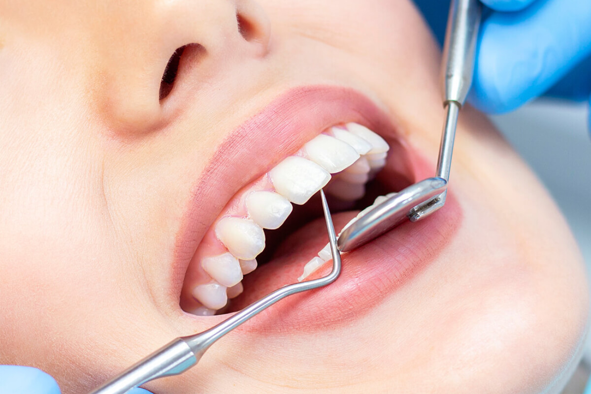 In Dallas TX area routine dental cleaning and experienced oral health care services